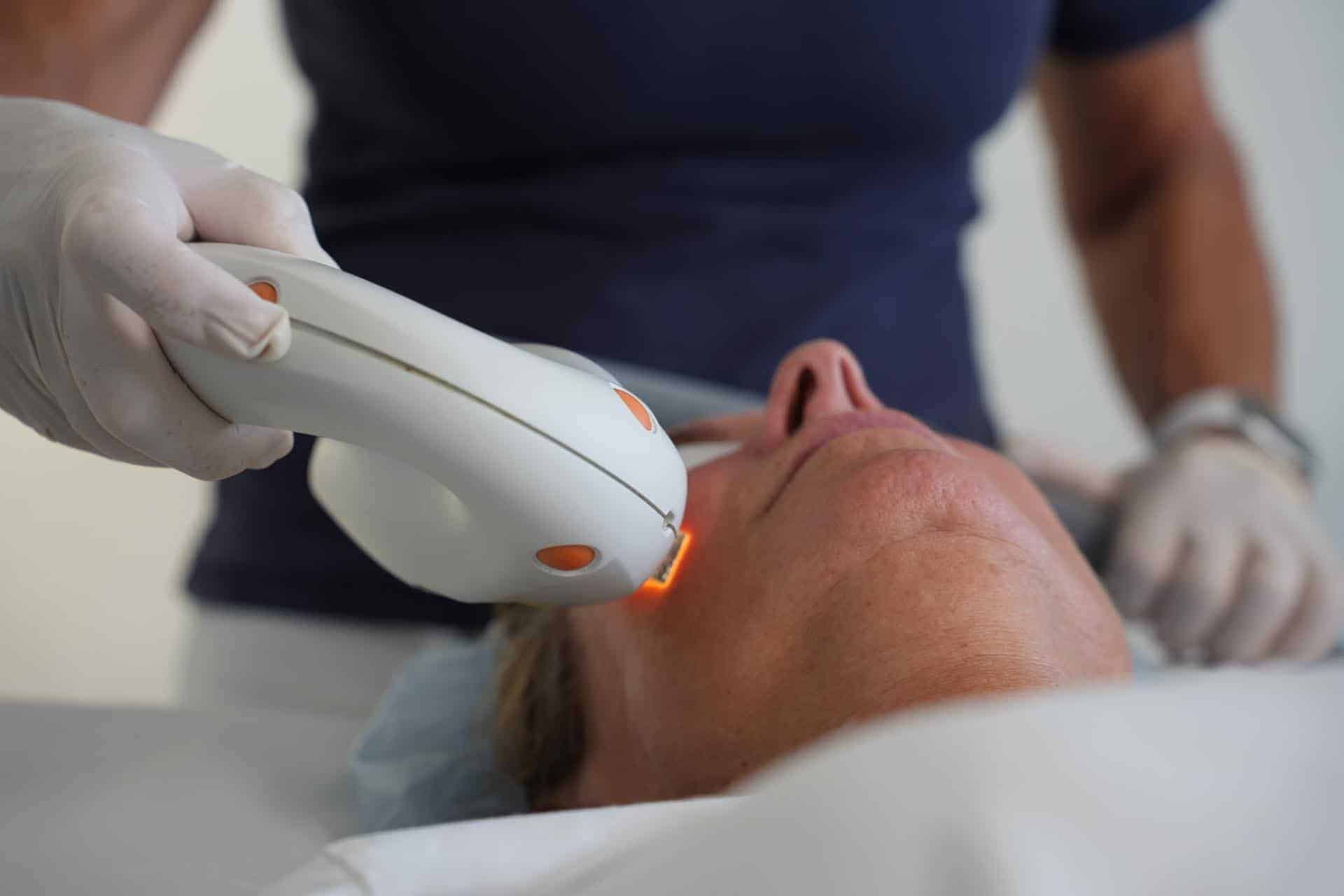 Laserbehandling på ansigt