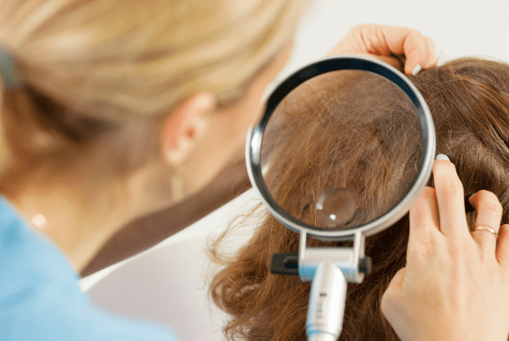 how to remove head lice