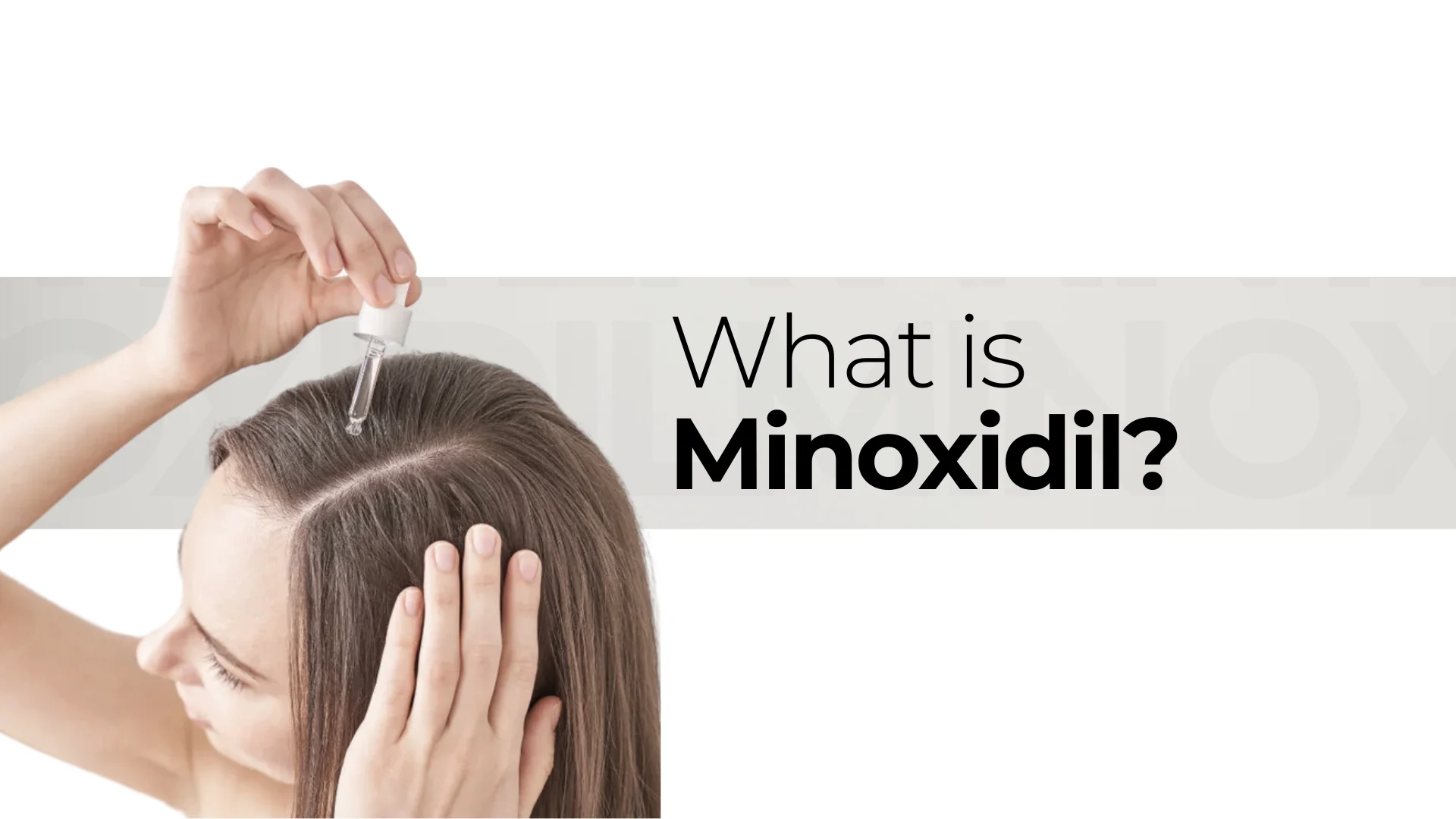 Minoxidil hair loss