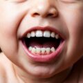 Dents de bébé qui poussent pas dans l&rsquo;ordre : Est-ce normal?