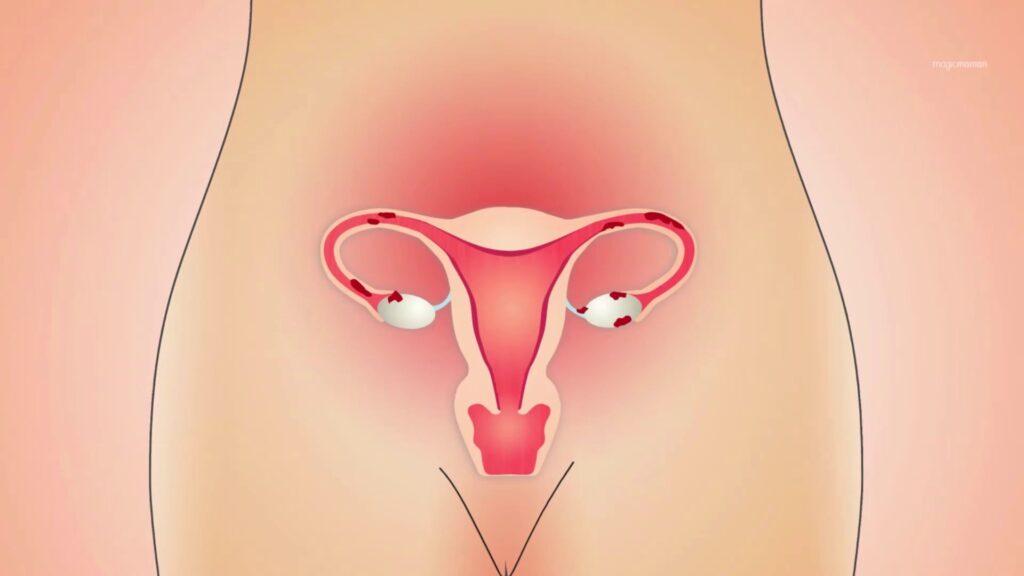 Glaire cervicale et ovulation : Comprendre les signes de fertilité naturels