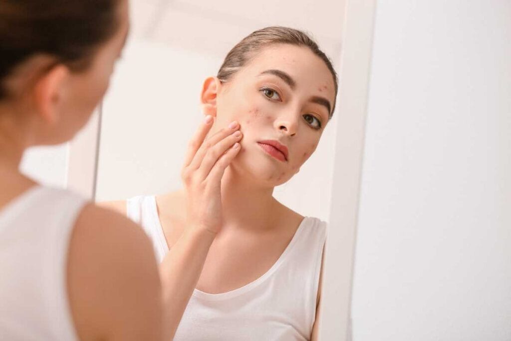 1 semaine sans fumer bienfaits peau 1
