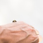 Venin d'abeille et peau