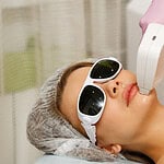 Épilation au laser du visage
