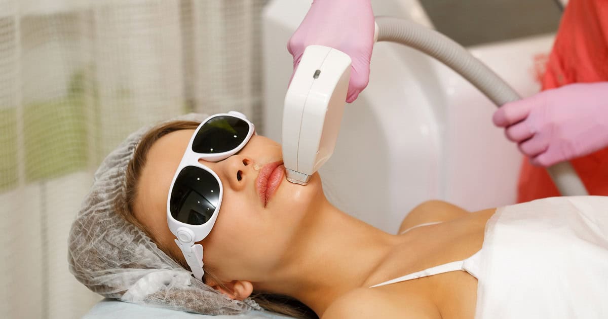 Épilation au laser du visage