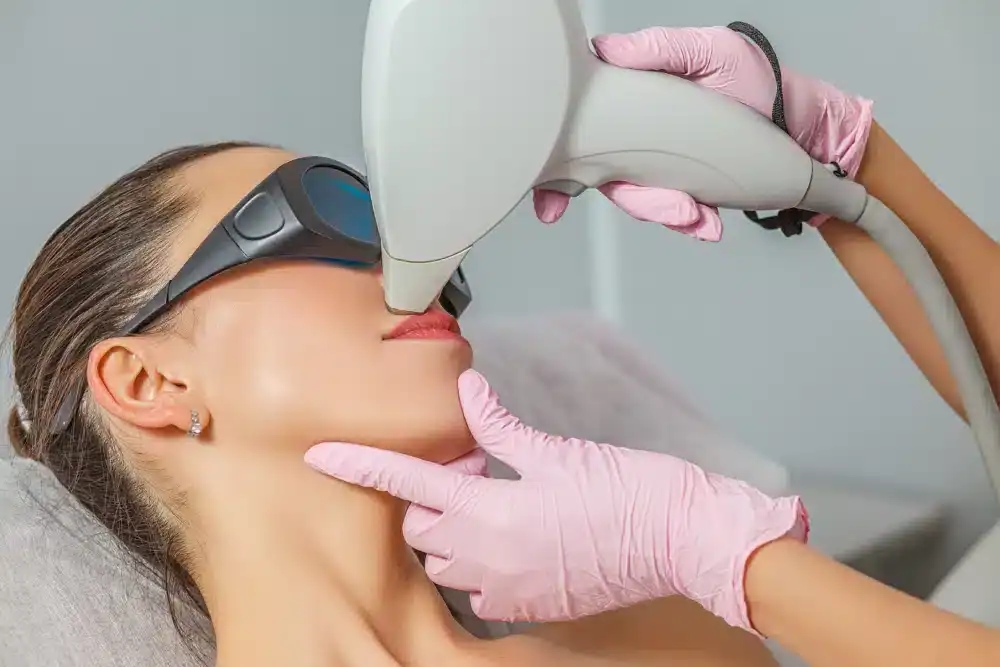 Épilation au laser du visage protocole