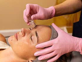 Micro-infusion