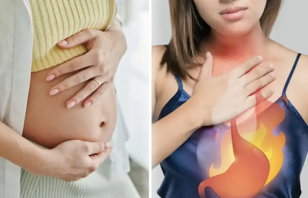 remontée acide grossesse