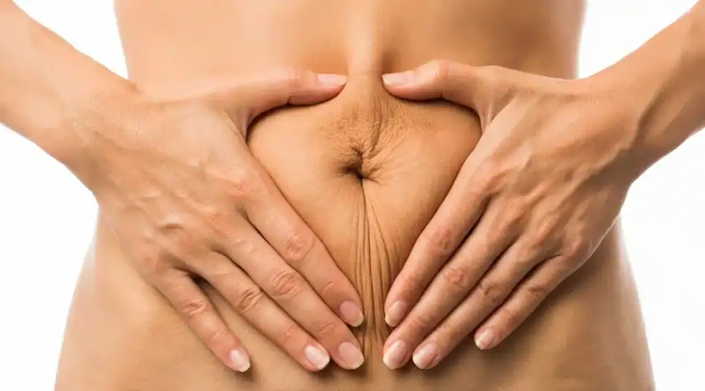 Pourquoi ai-je une ligne sur le ventre sans être enceinte