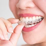 invisalign avis