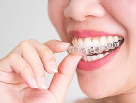 invisalign avis