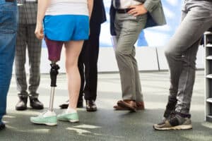 Chicago Amputation Loss Limbs Lawyers