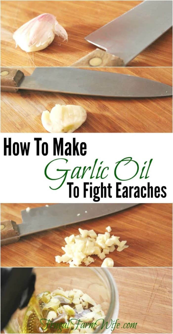 Image shows a collage of photos cutting garlic, with text that reads "How to Make Garlic Oil to Fight Earaches"
