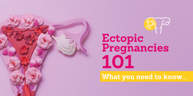 Ectopic Pregnancies
