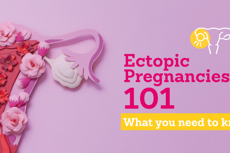 Ectopic Pregnancies
