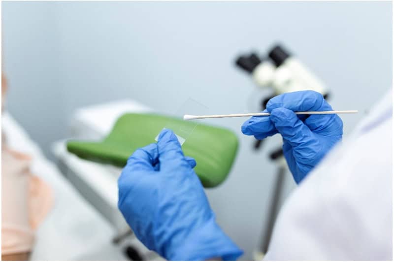 pap-smear