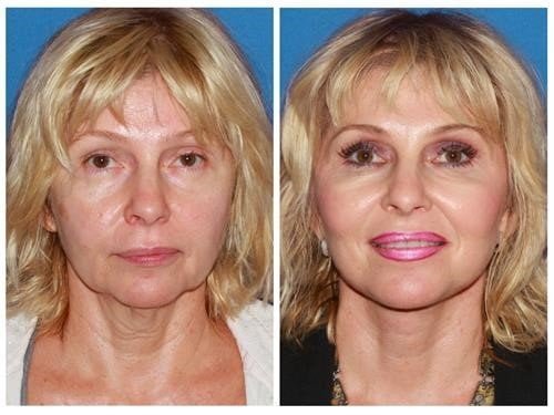 Plastic Surgery
