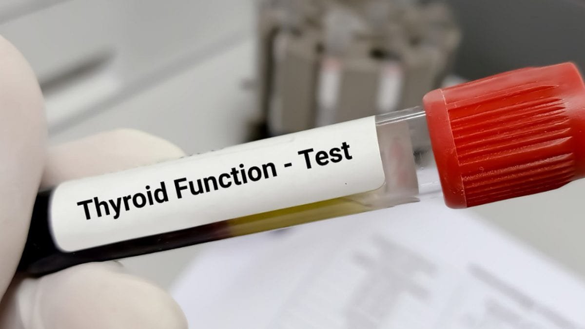 What Are The Five Thyroid Tests?
