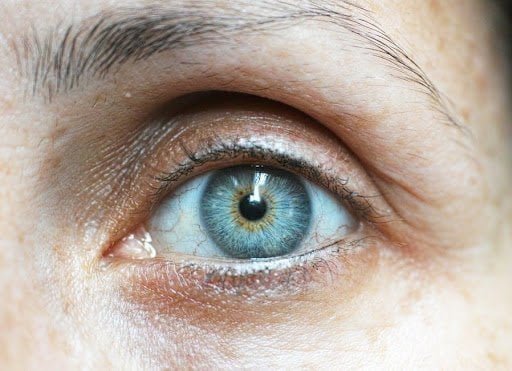 What Causes Eye Bags? Remedies And How To Prevent Them