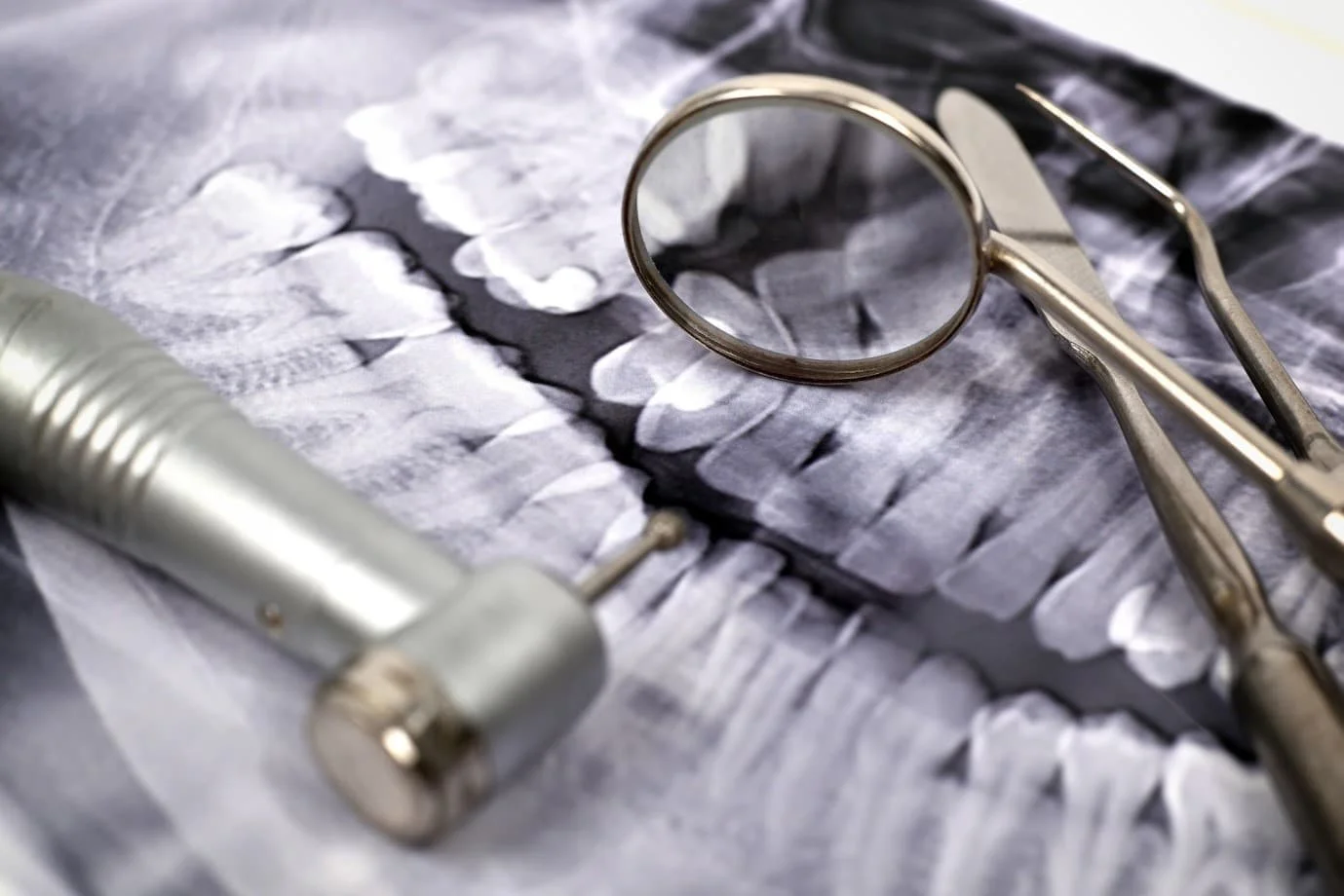 The Importance Of Dental X-Rays