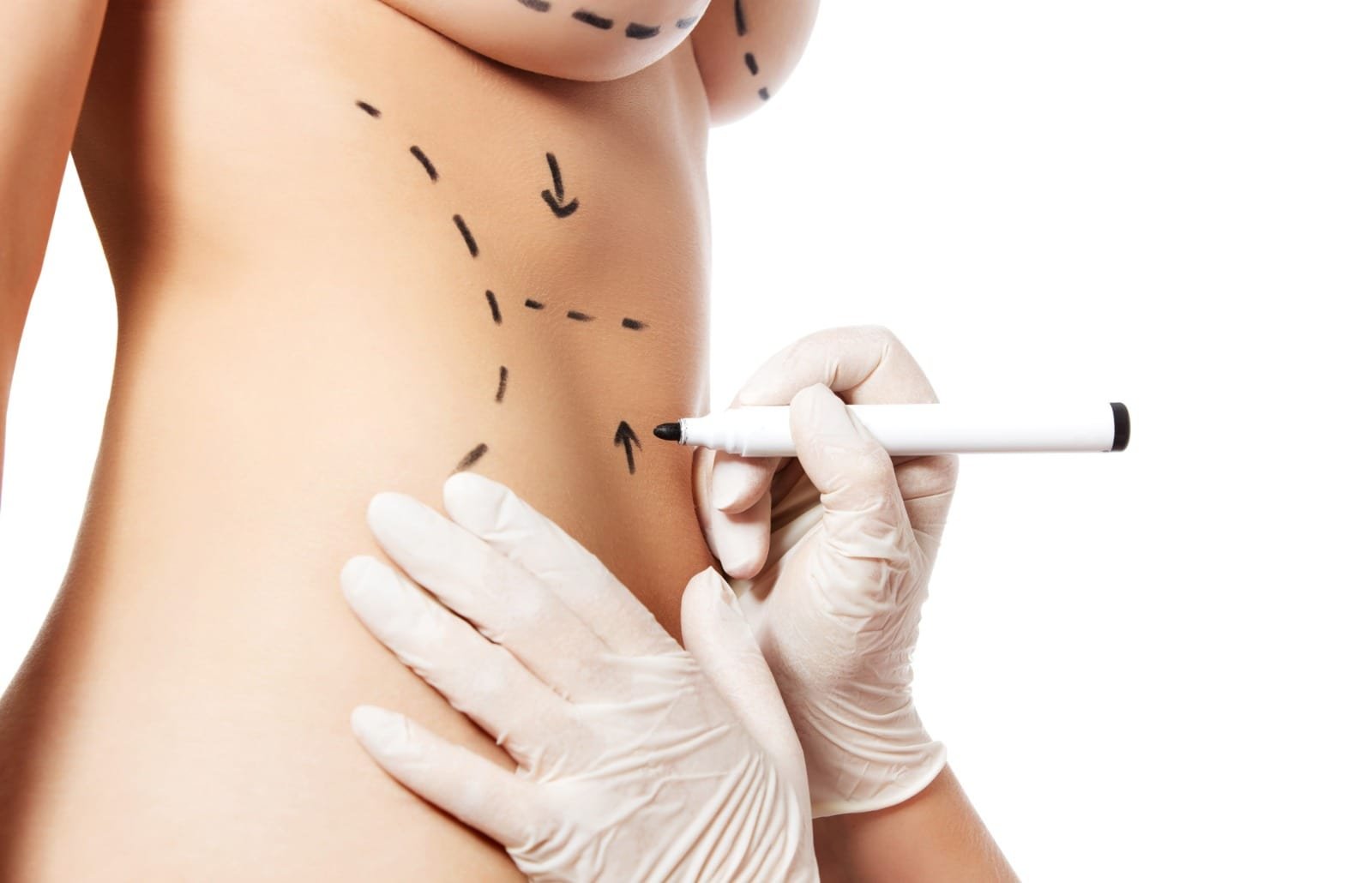 Body Contouring