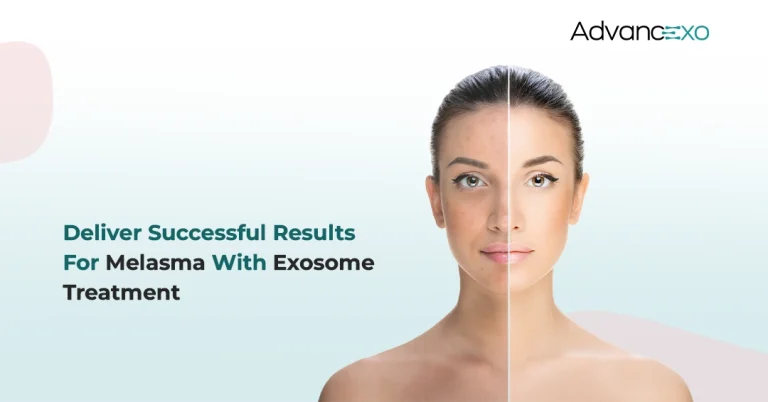 Read more about the article Deliver Successful Results for Melasma with Exosome Treatment