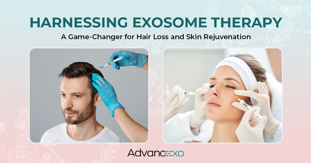 You are currently viewing Harnessing Exosome Therapy: A Game-Changer for Hair Loss and Skin Rejuvenation