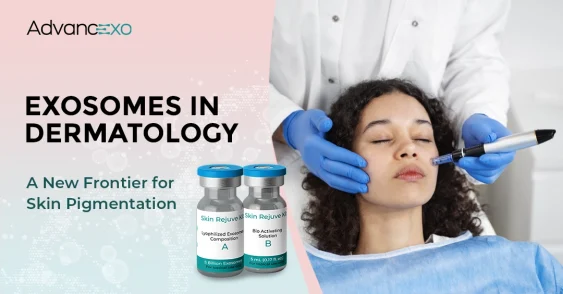 Exosomes in Dermatology: A New Frontier for Skin Pigmentation