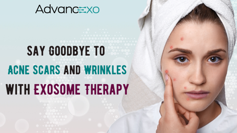 Read more about the article Say Goodbye to Acne Scars and Wrinkles with Exosome Therapy