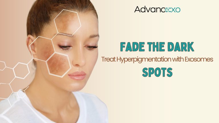 Read more about the article Fade the Dark Spots: Treat Hyperpigmentation with Exosomes