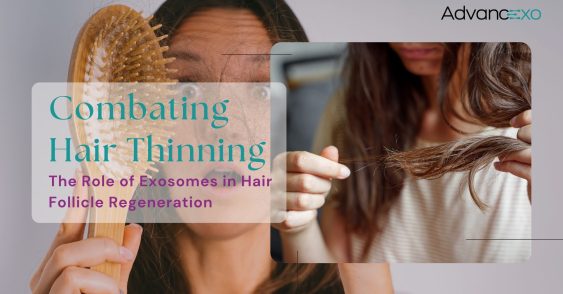 Combating Hair Thinning: The Role of Exosomes in Hair Follicle Regeneration