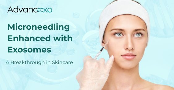 Microneedling Enhanced with Exosomes: A Breakthrough in Skincare