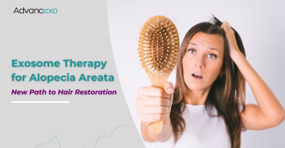 Exosome Therapy for Alopecia Areata: New Path to Hair Restoration