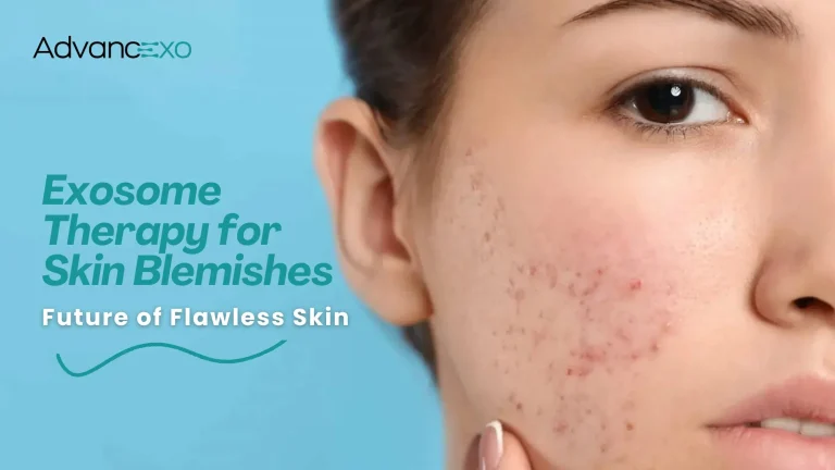 Read more about the article Exosome Therapy for Skin Blemishes: Future of Flawless Skin