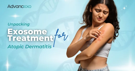 Unpacking Exosome Treatment for Atopic Dermatitis