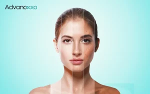 Exosome-Therapy-for-Anti-Aging