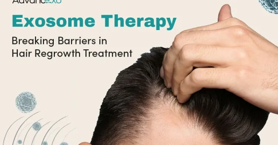 Exosome Therapy: Breaking Barriers in Hair Regrowth Treatment