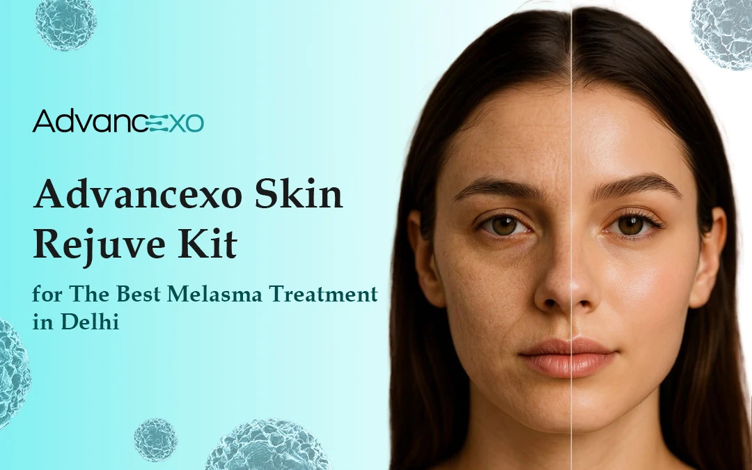 You are currently viewing Advancexo Skin Rejuve Kit for The Best Melasma Treatment in Delhi