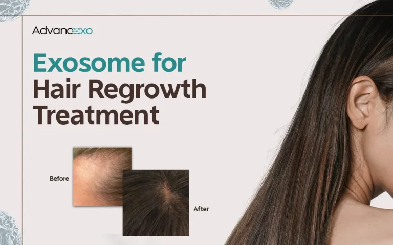 Read more about the article Exosome for Hair Regrowth Treatment: What Science Tell Us, What to Expect