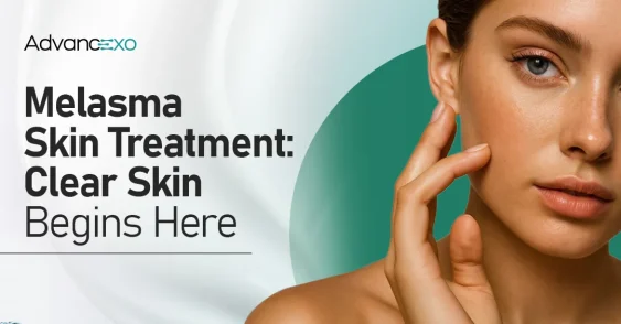 Melasma Skin Treatment​- Clear Skin Begins Here