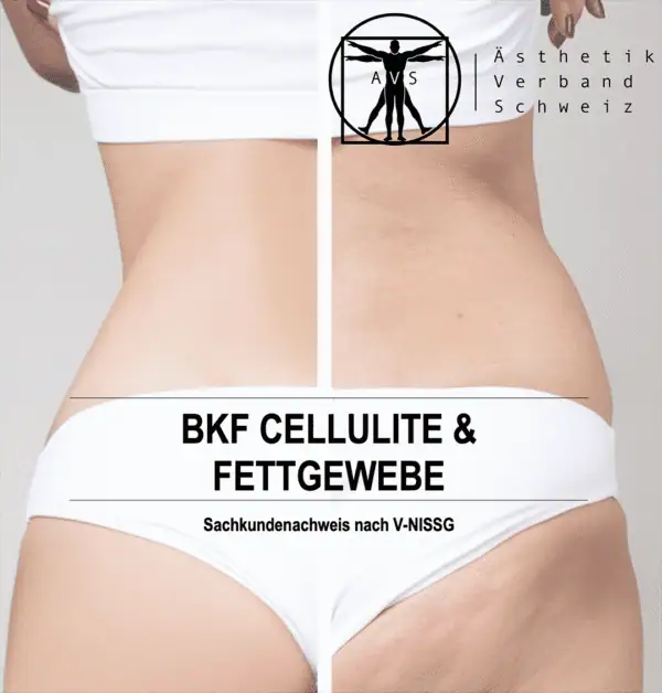 BKF Cellulite und Fettpolster (Dezember 2025) Z3