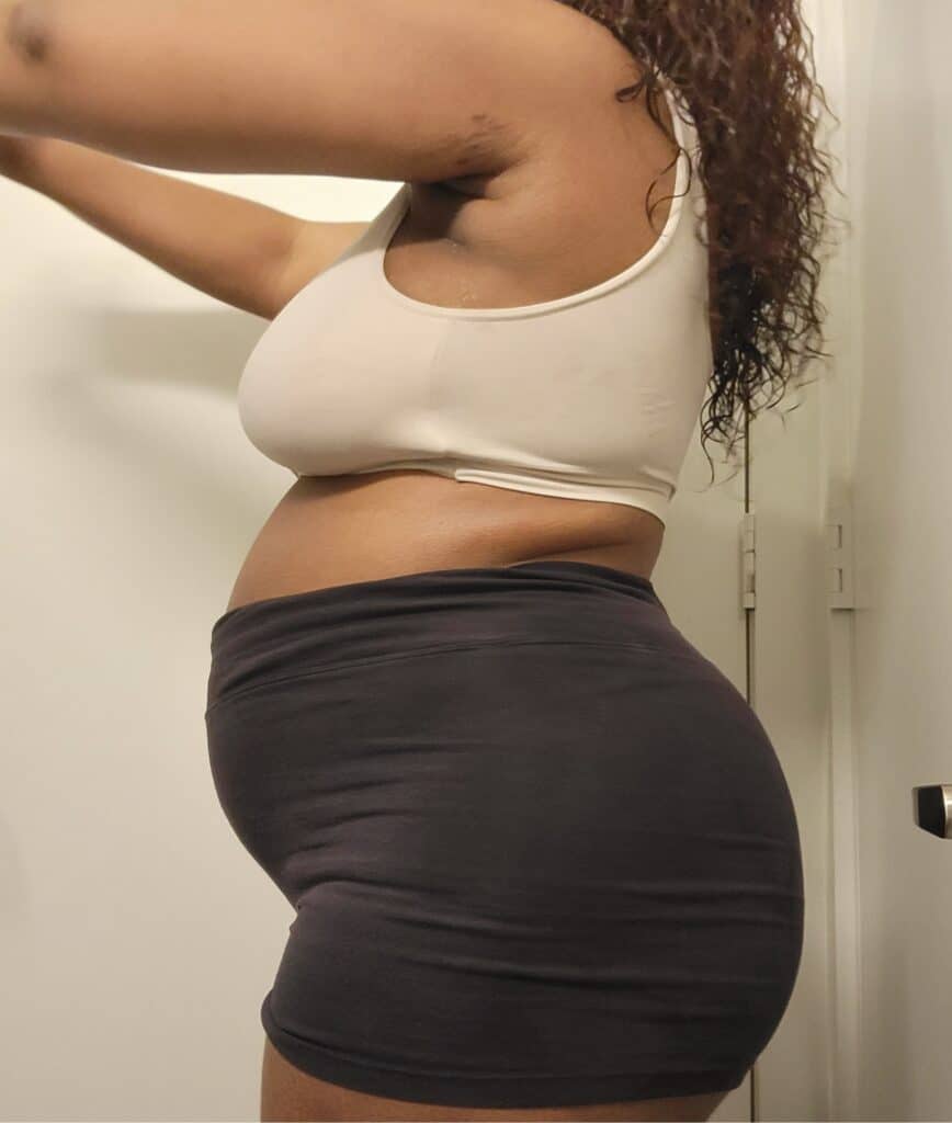 My body 2 weeks postpartum