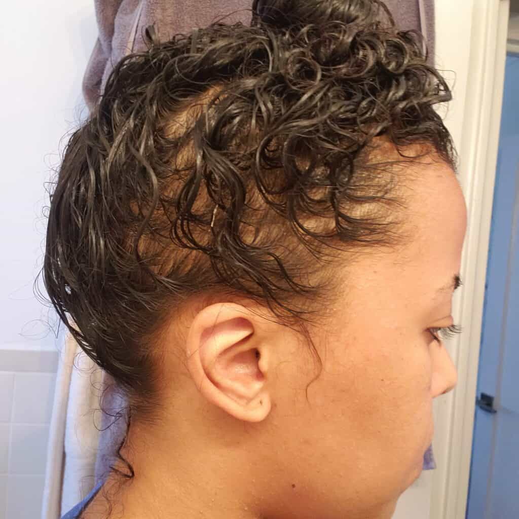 Side profile showing visible thinning and patchy hair loss near the temple, dated around August 2020.