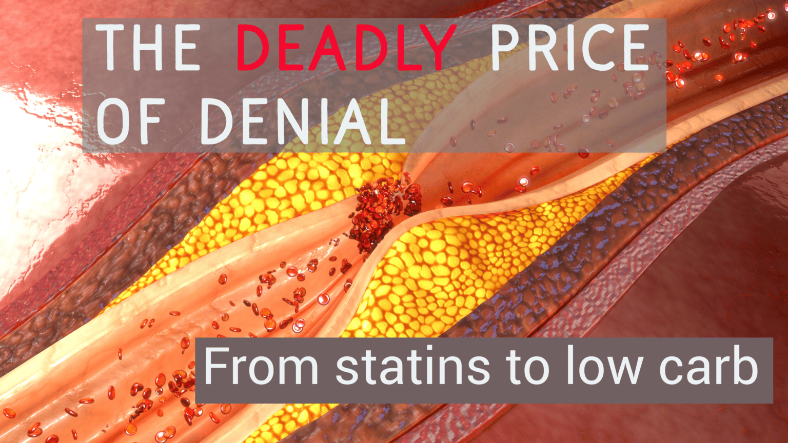The deadly price of denial: from statins to low carb 669ba302a03cd.png