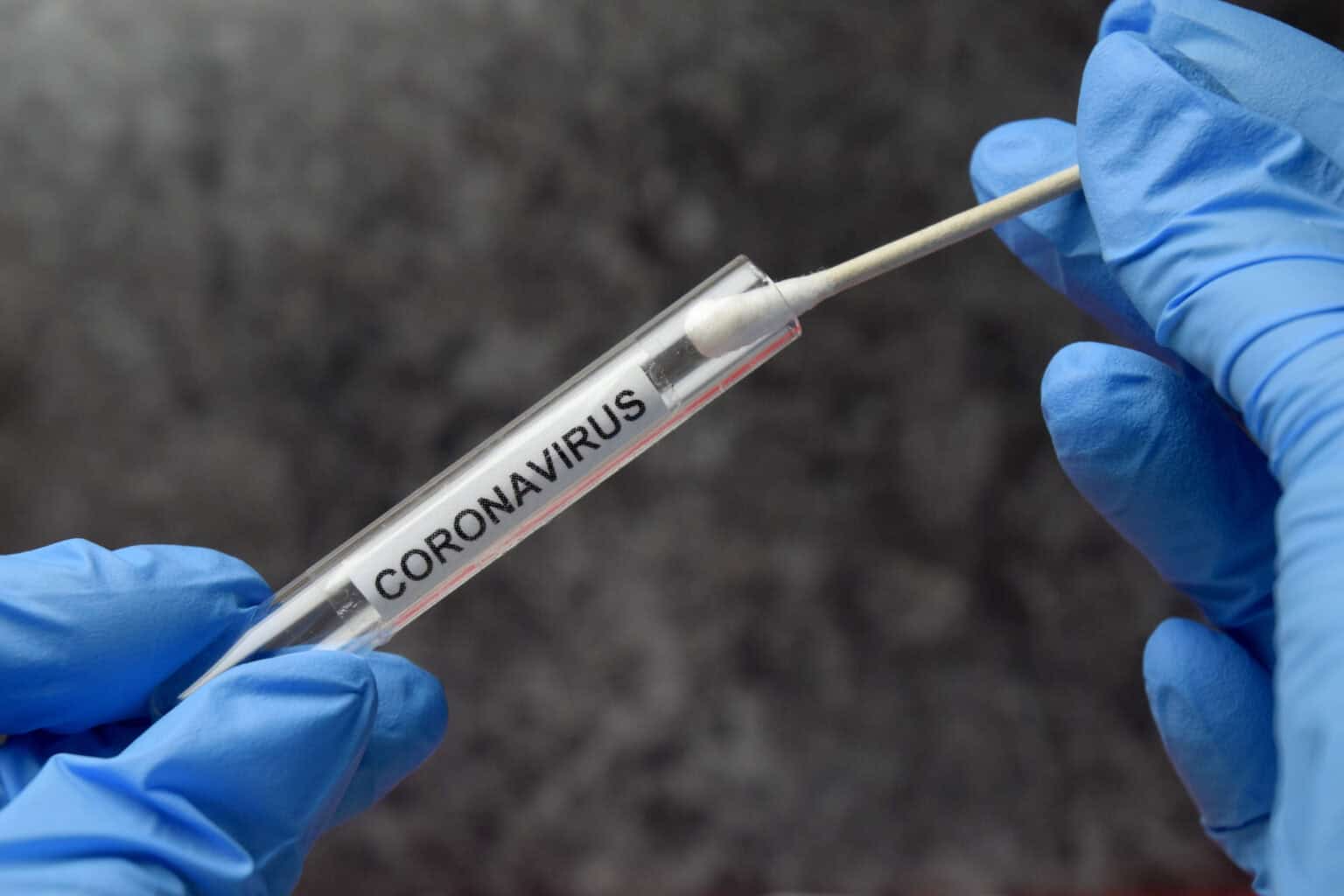 The Wild West of coronavirus testing 669b8539dc43d.jpeg
