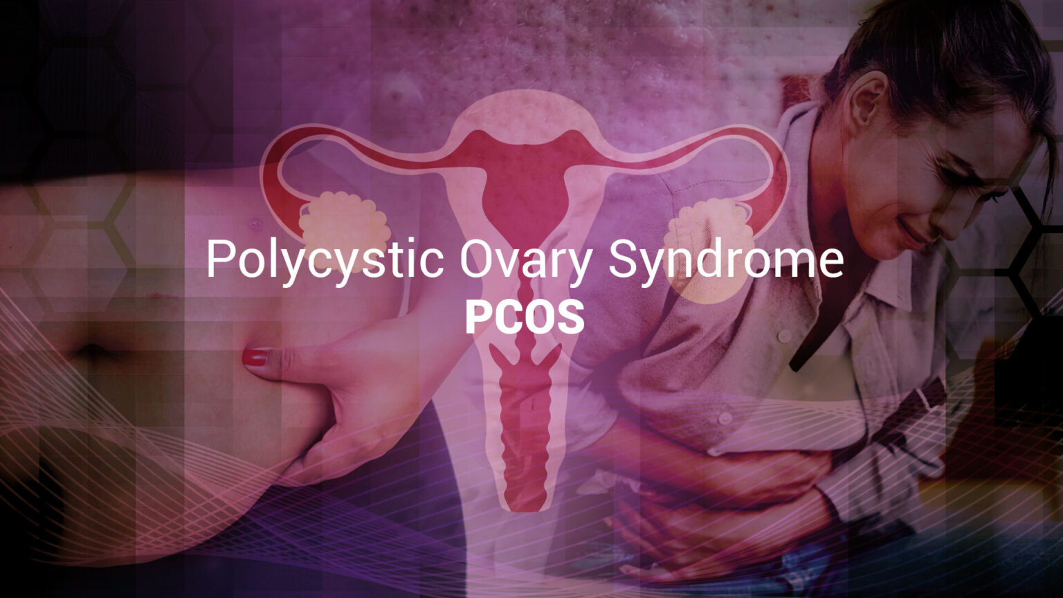 PCOS beyond reproduction: the metabolic roots of an hormonal disorder 69722f9e1fdd7.jpeg