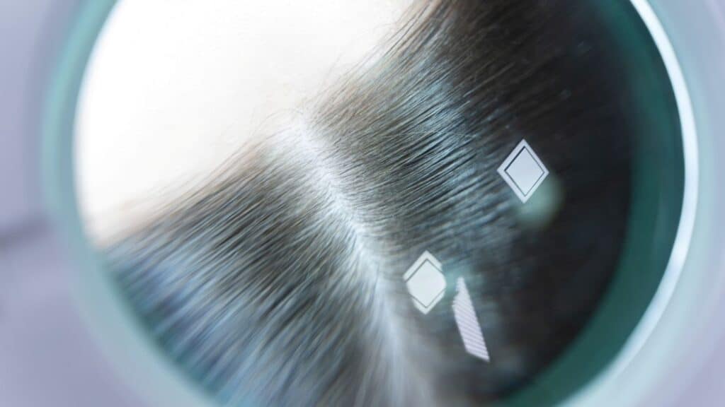 Close-up of hair strands with density measurement markers.
