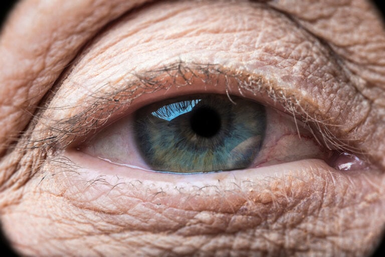 SZEMRÁNCVIRÁGKRÉM