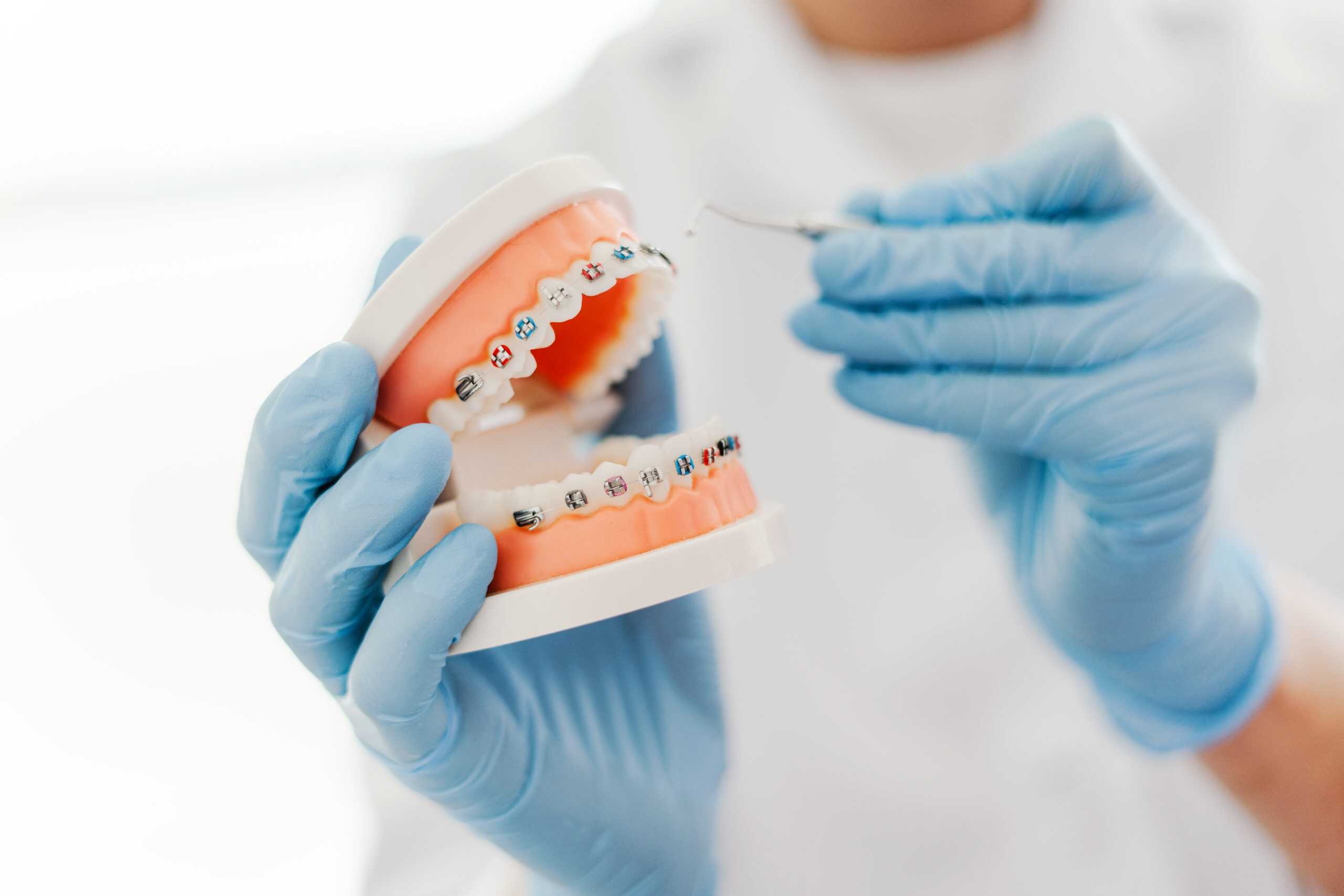 klowen brackets KLOwen Orthodontics Unveils Revolutionary Custom Metal SL Solution main image 0