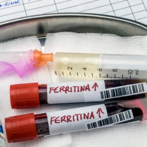 differenza tra ferro e ferritina nelle analisi del sangue